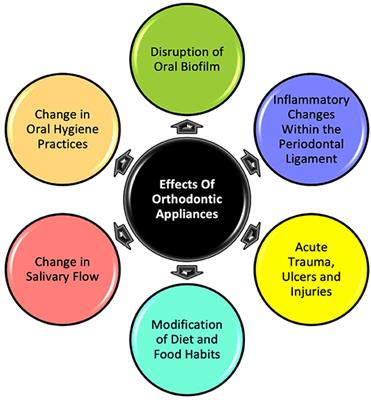 Effect of Orthodontic Appliances on the Oral Environment and Microbiome